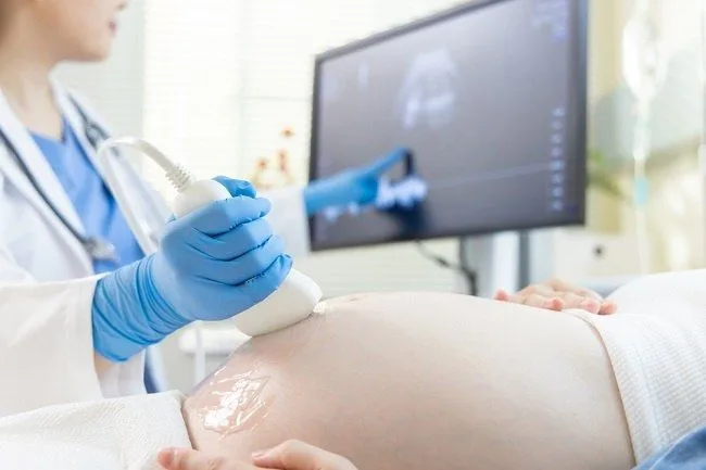 4 Tugas Bidan yang Sangat Mulia untuk Ibu dan Anak 2 tugas bidan